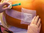 aplikace epidurální analgezie foto5