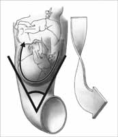 flexe a vnitřní rotace hlavičky plodu