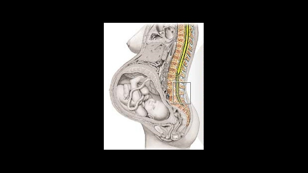 Proč lékaři v prenatální poradně zjišťují rozměry pánve? - obrázek