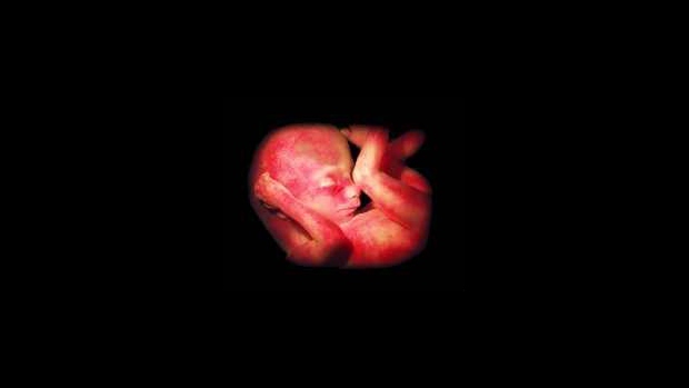 Přehled vývoje embrya a plodu - obrázek
