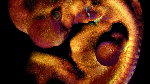 Embryopatie - obrázek