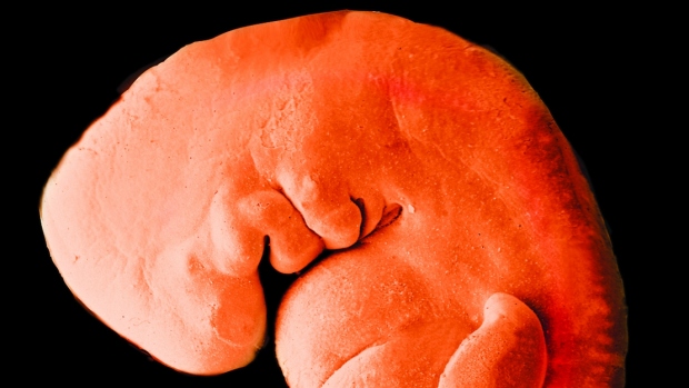 Vývoj embrya - obrázek