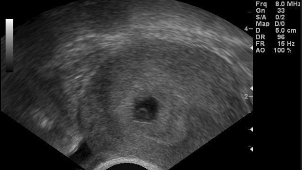 Zkratky při vyšetřování ultrazvukovým přístrojem - obrázek