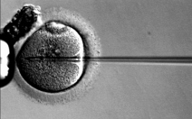 Mimotělní oplodnění (IVF + ET) - obrázek