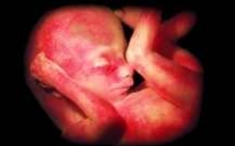 Přehled vývoje embrya a plodu - obrázek