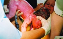 Rodička žalovala nemocnici kvůli porodu, prohrála a musí zaplatit 100 000 - obrázek