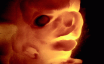 7. týden těhotenství - obrázek