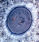 Vajíčko (odborně oocyt)