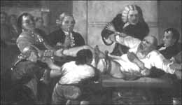 Operační výkon (amputace dolní končetiny) před zavedením anestezie (St. Thomas Hospital, London, 1775)