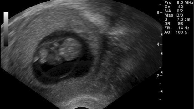 9. týden těhotenství - obrázek