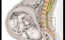 Porodní mechanizmus - obrázek